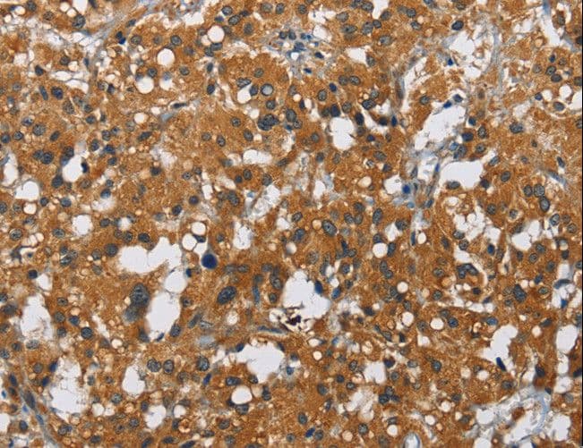Polyclonal Rabbit anti-Human CARD9 Antibody (IHC)