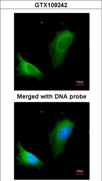 ARG1 / Arginase 1 Antibody (aa1-322)