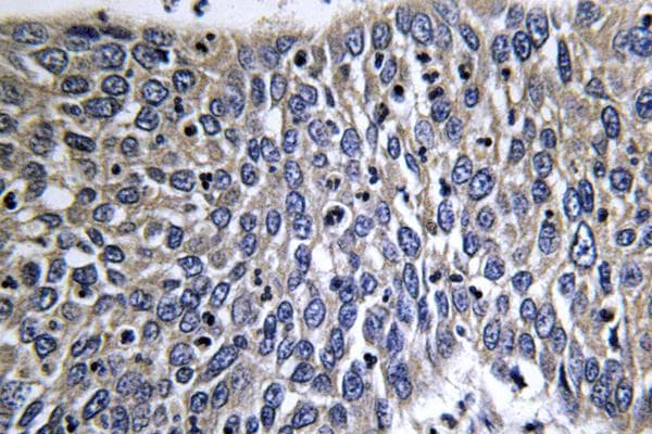 Polyclonal Rabbit anti-Human DCX / Doublecortin Antibody (Lys292, IHC, WB)