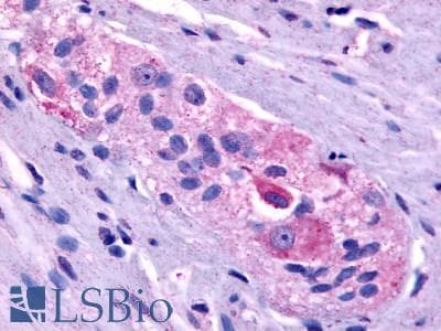 IHC-plus™ Polyclonal Rabbit anti-Human PROKR1 Antibody (C-Terminus, IHC)