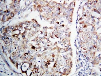 MAP2K1 / MKK1 / MEK1 Antibody (aa353-367)