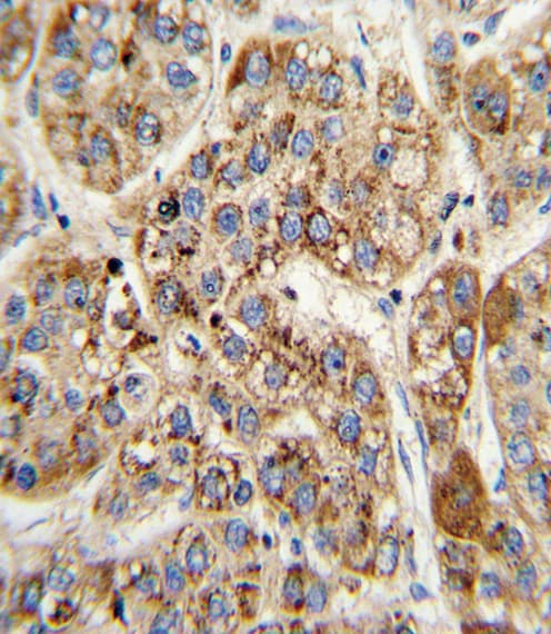 MCCC2 / MCCB Antibody (aa163-189)