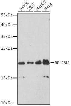 RPL26L1 Antibody