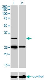Monoclonal Mouse anti-Human STAR Antibody (clone 5F9, WB)