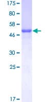 Human PSPH Protein (Recombinant GST)