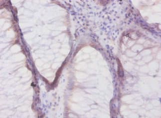 DEFB1 / BD-1 Antibody