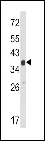 Polyclonal Rabbit anti-Human ARPC1A Antibody (aa286-315, IHC, IF, WB)