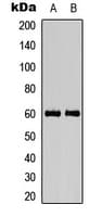 CAMK4 / CaMK IV Antibody (phospho-Thr200)