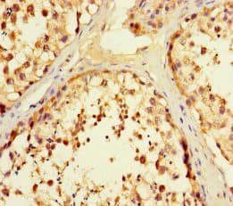 F2R / Thrombin Receptor / PAR1 Antibody