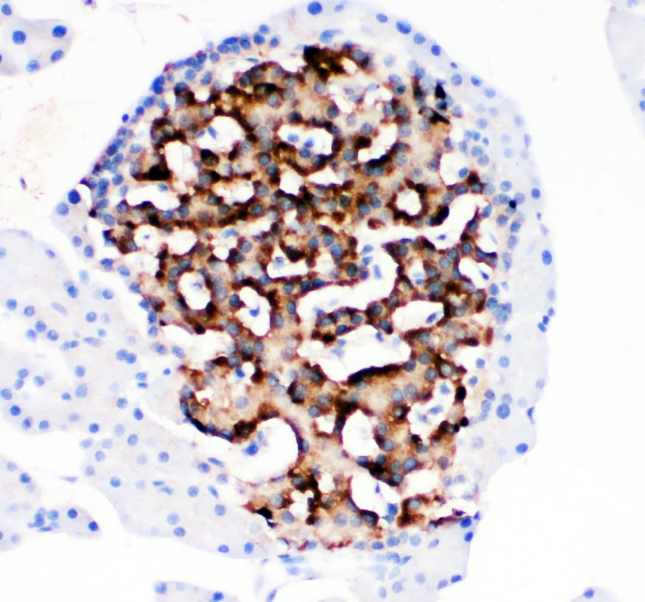 HSD11B1 / HSD11B Antibody (aa16-33)