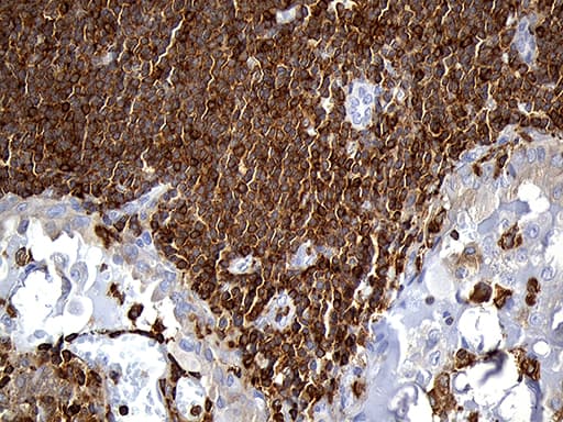 SH3BP1 Antibody (clone OTI1C9)
