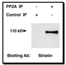 STRN / Striatin Antibody (Internal)