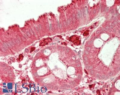 PathPlus™ CTSS / Cathepsin S Antibody (aa 115-331)