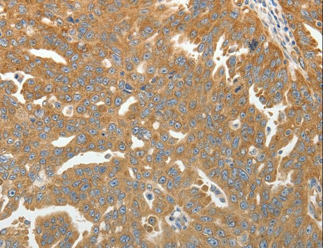 Polyclonal Rabbit anti-Human RPLP0 Antibody (IHC, WB)
