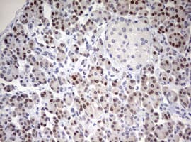 TOP2A / Topoisomerase II Alpha Antibody (aa1100-1531, clone OTI5E6, Carrier-free)