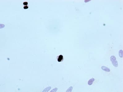 H3F3B Antibody