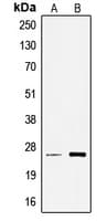 TCEAL6 Antibody (Internal)
