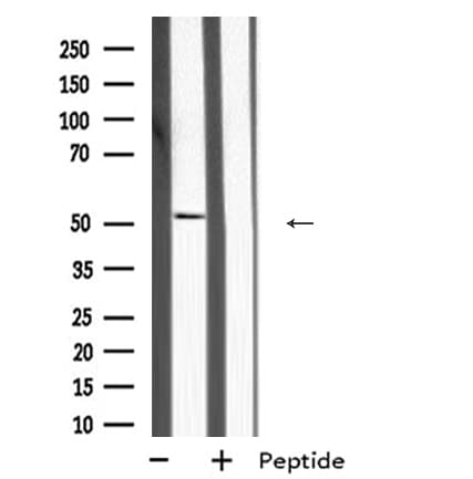 MKNK2 / MNK2 Antibody