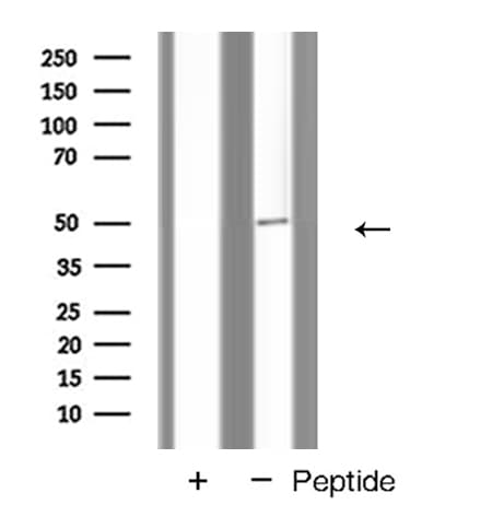 INHBB / Inhibin Beta B Antibody