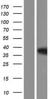 ARNT / HIF-1-Beta Protein (Over-Expression Lysate Myc-DDK (Flag))