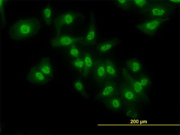 NFKB1 / NF-Kappa-B Antibody (clone 3F6)