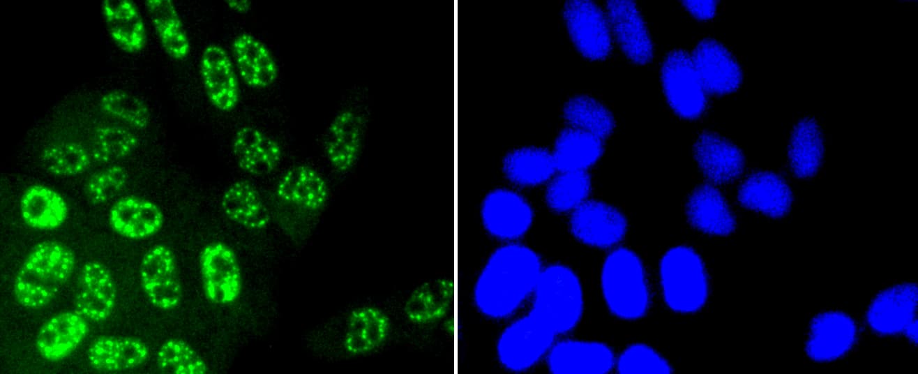 JNK1+2+3 Antibody (JNK1 phospho-Thr183 and JNK2 pThr183 and JNK3 pThr221)