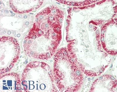 IHC-plus™ Polyclonal Rabbit anti-Human EEF1A1 Antibody (IHC, IF, WB)
