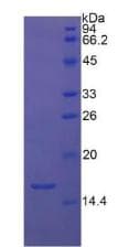 Human TGFB1 / TGF Beta 1 Protein (Recombinant His, N-Terminal)
