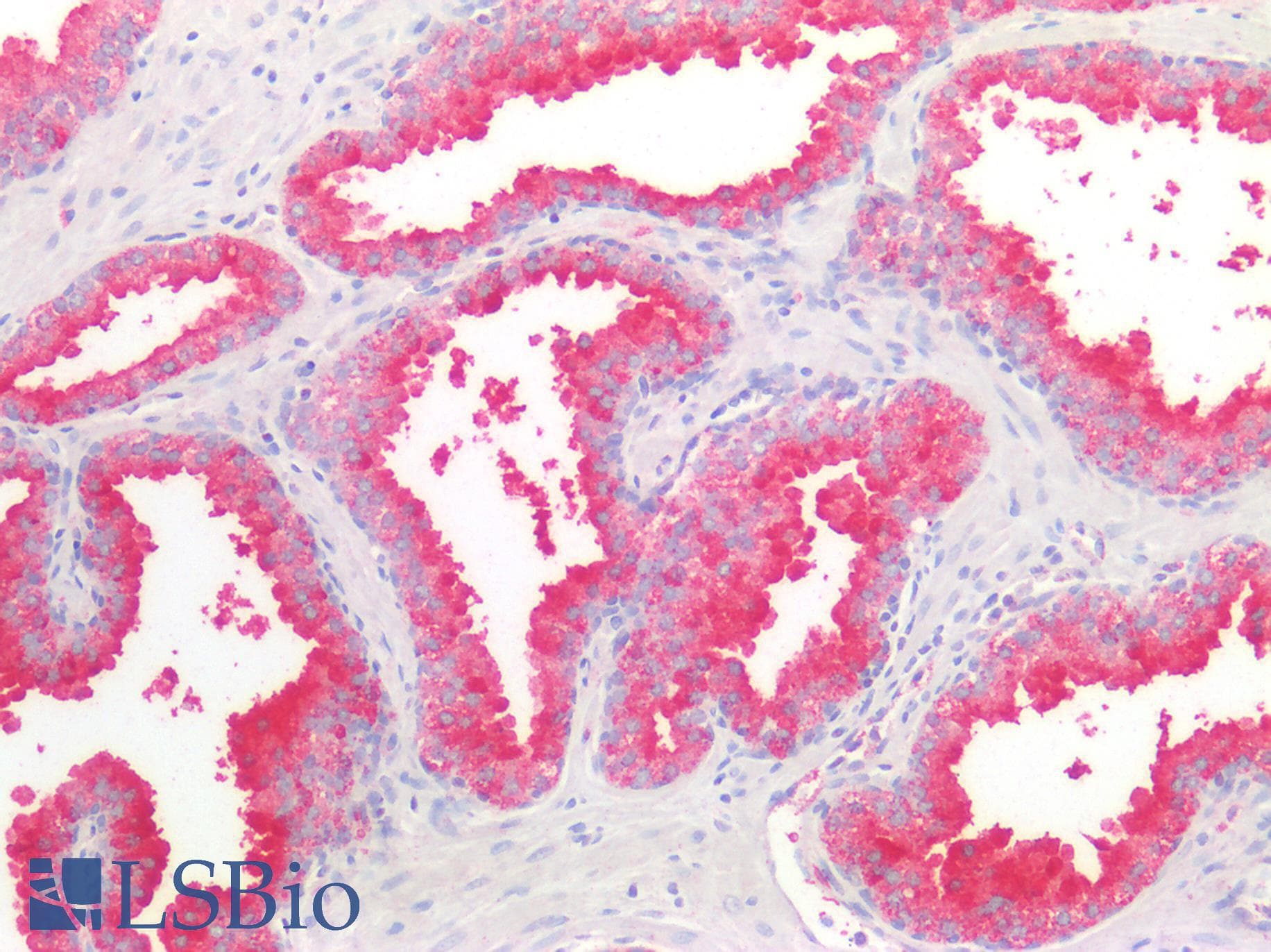 PathPlus™ DPP4 / CD26 Antibody (N-Terminus)