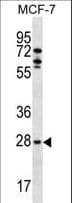 MLF1 Antibody (aa215-244)
