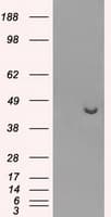 PME-1 / PPME1 Antibody (clone OTI2C5)