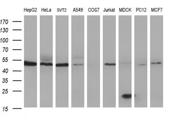 HERPUD1 / HERP Antibody (clone OTI1A2)