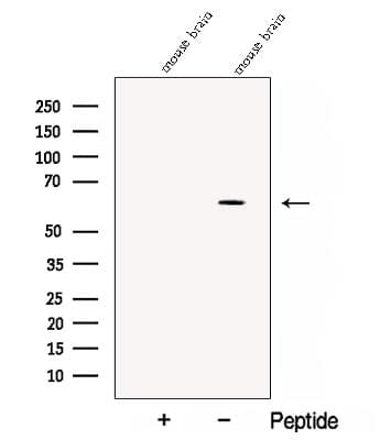 Polyclonal Rabbit anti-Human CPNE6 / N-COPINE Antibody (IF, WB)