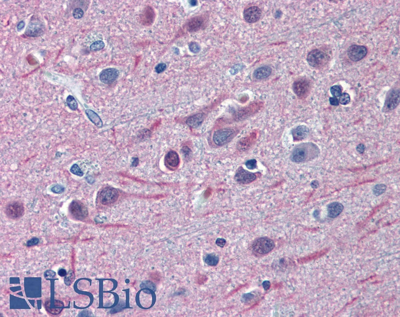IHC-plus™ TUBB2A / Tubulin Beta 2A Antibody (clone 4B12)