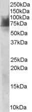 SLC6A4 / SERT Antibody (aa116-126)