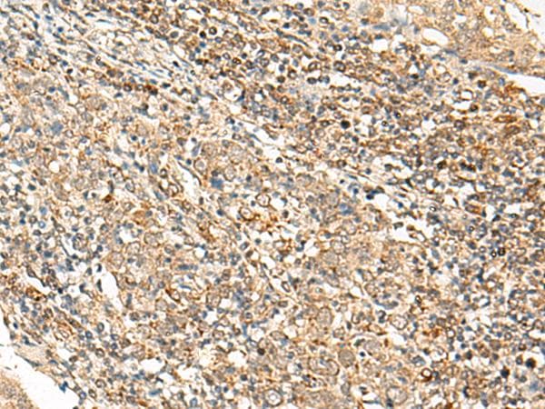 Polyclonal Rabbit anti-Human SNAPC5 Antibody (IHC)