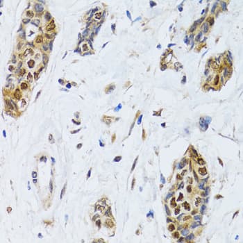Polyclonal Rabbit anti-Human CIRP / CIRBP Antibody (IHC, IF, WB)