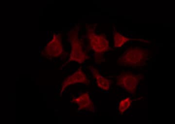 MC5R / MC5 Receptor Antibody