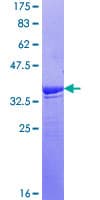 Human PTPN7 / HEPTP Protein (Recombinant GST, N-terminus)