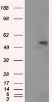 TUBA8 / Tubulin Alpha 8 Antibody (clone OTI2G6, Carrier-free)