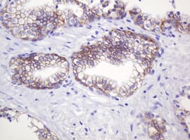 CTNND1 / p120 Catenin Antibody (clone OTI2E8)