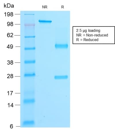PathPlus™ CTNNB1 / Beta Catenin Antibody (clone rCTNNB1/2173)