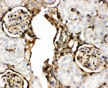 ANXA5 / Annexin V Antibody (aa2-320)