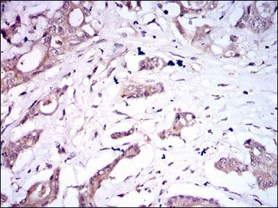 Monoclonal Mouse anti-Human ALK3 / BMPR1A Antibody (clone 4B7B2, Amino Acid: 179-378, IHC, WB)