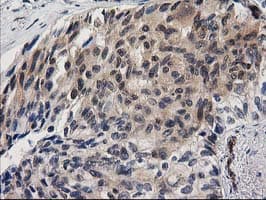 MAPRE2 / EB2 Antibody (clone OTI1D10)