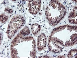 PDLIM2 / SLIM Antibody (clone OTI3B5)