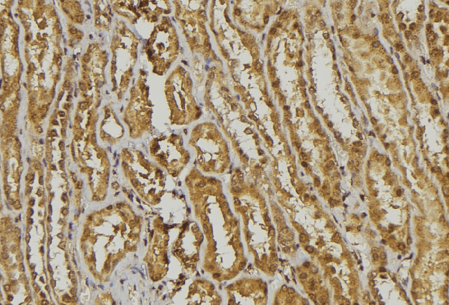 Polyclonal Rabbit anti-Human DEFA1 + DEFA3 Antibody (IHC, WB)
