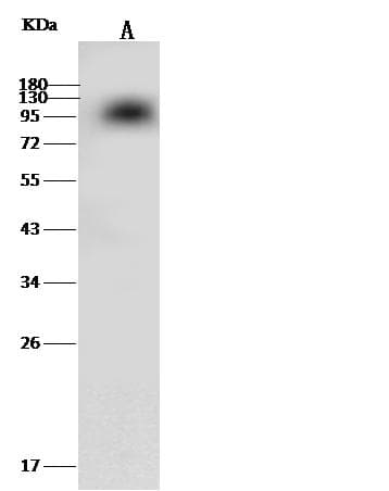 F2 / Prothrombin / Thrombin Antibody (clone 318, Preservative Free)
