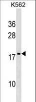DR1 / NC2 Antibody (aa83-112)