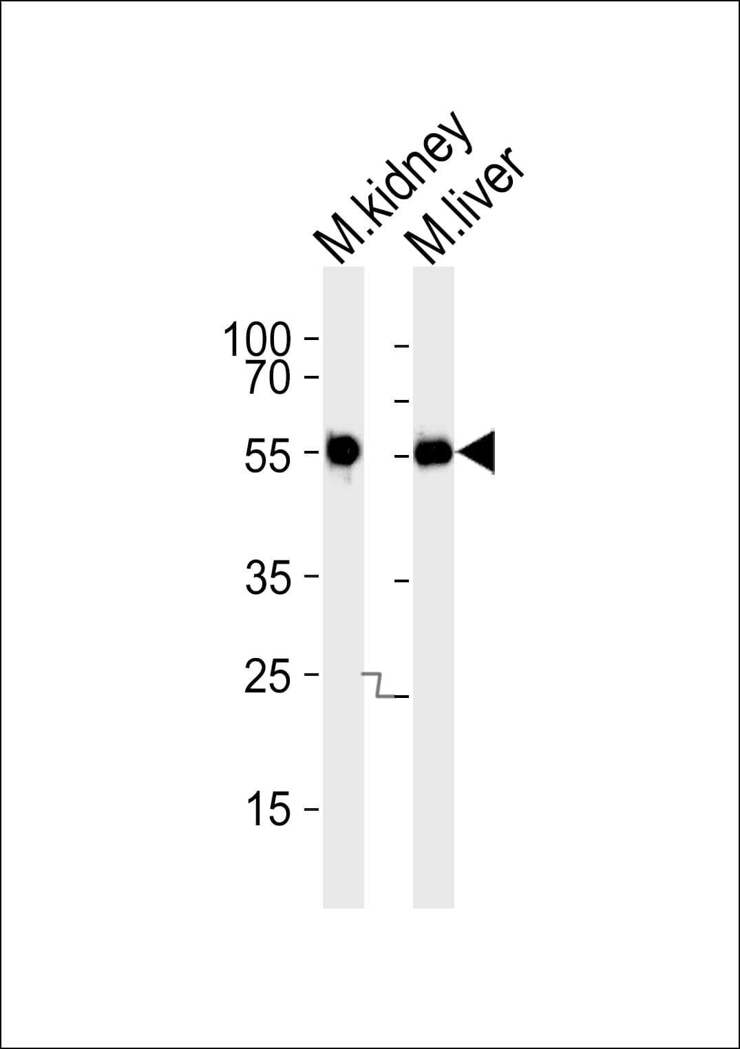 CSNK1G3 / CKI-Gamma 3 Antibody (aa333-361)